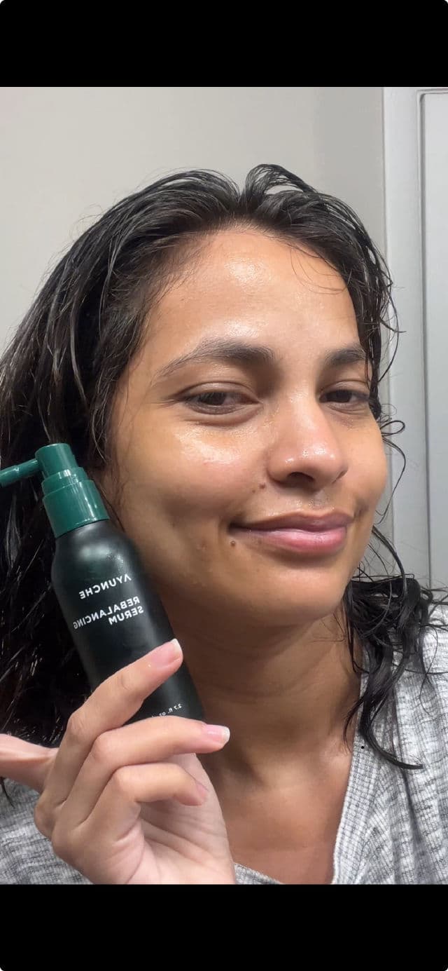 AYUNCHE Rebalancing Serum review photo by zurimzd