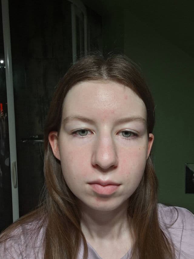 The Ordinary Soothing & Support Barrier Serum review photo by igad