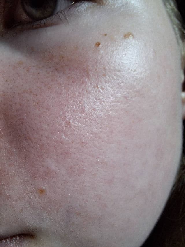 Avene Cicalfate+ Restorative Protective Cream review photo by igad