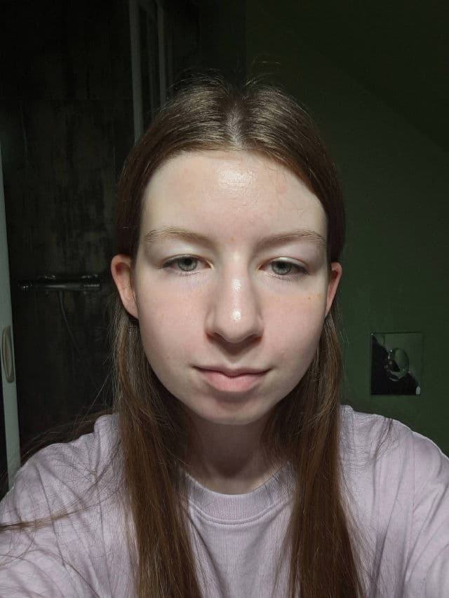 The Ordinary Soothing & Support Barrier Serum review photo by igad