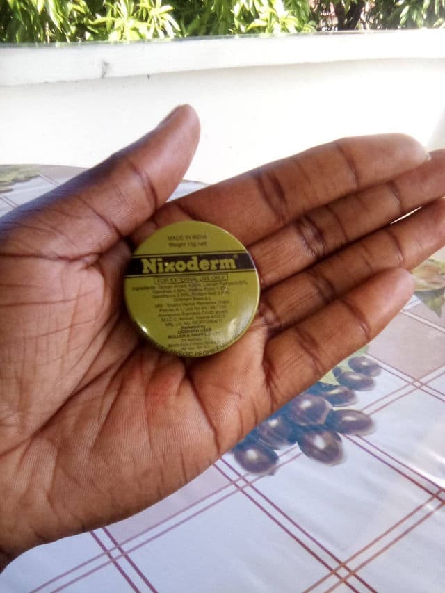Nixoderm Ointment review photo by Steffie