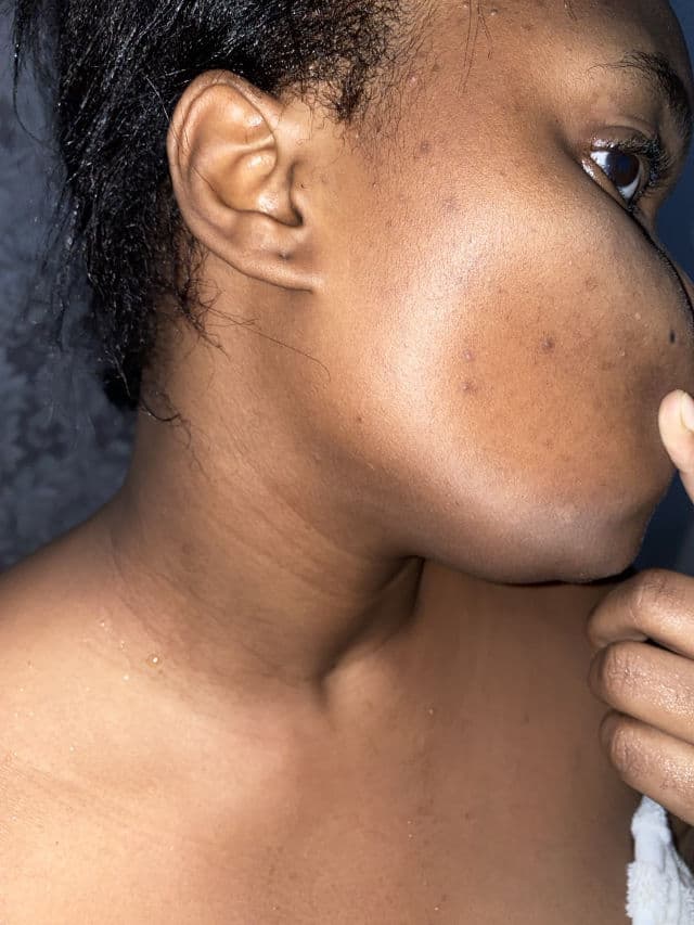 Centellian24 360° Shot PDRN Active Serum review photo by Dorianny