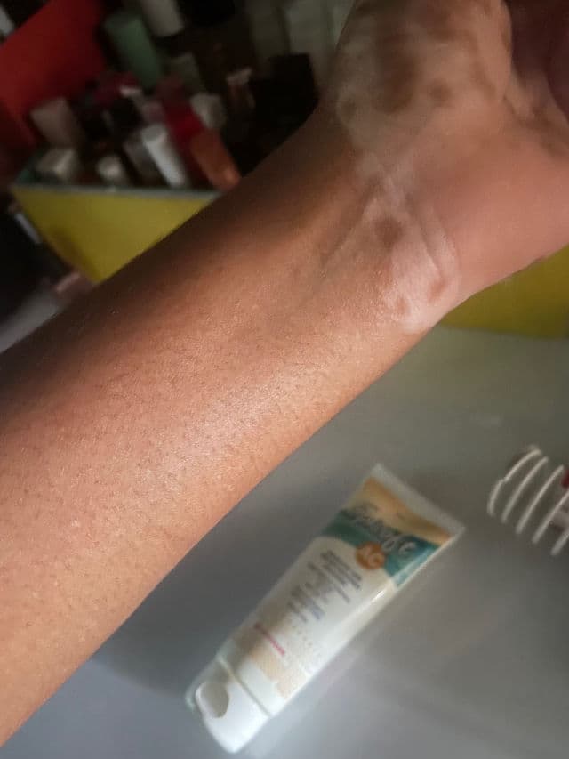 Glenmark Episoft AC Moisturizer with Sunscreen, SPF 30+ review photo by ish25