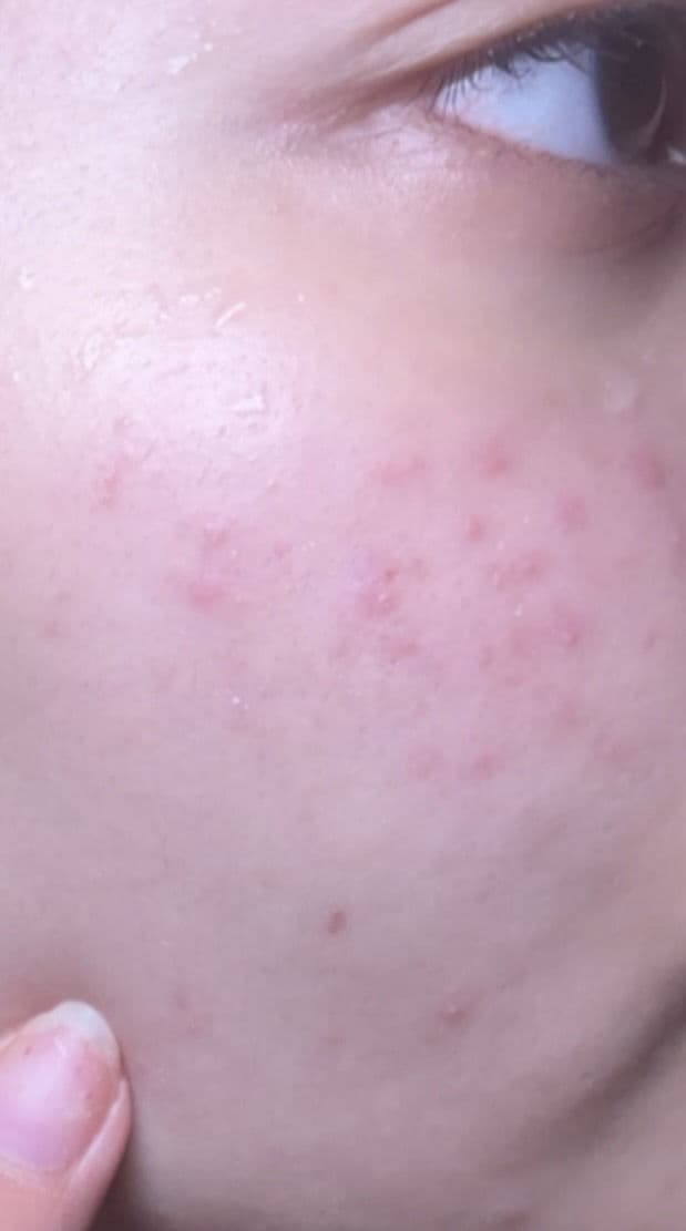 numbuzin No.5 Glutathione Vitamin C Concentrated Serum review photo by sofiachen