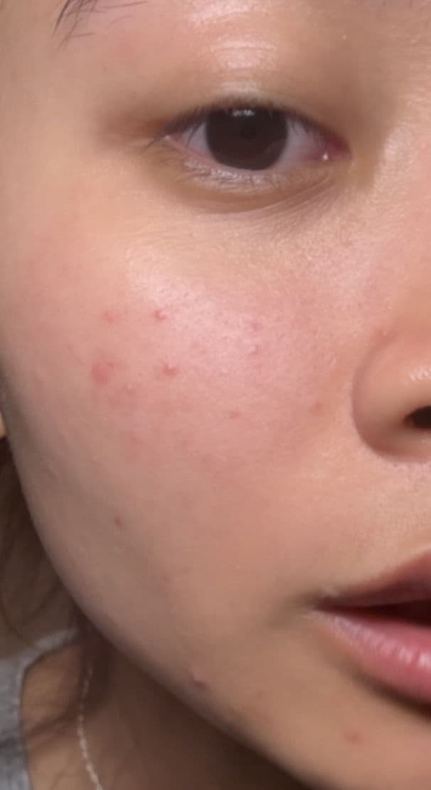 numbuzin No.5 Glutathione Vitamin C Concentrated Serum review photo by sofiachen