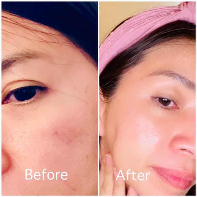 vividraw Niacin Onion All Clear Ampoule review photo by Thuhienpham