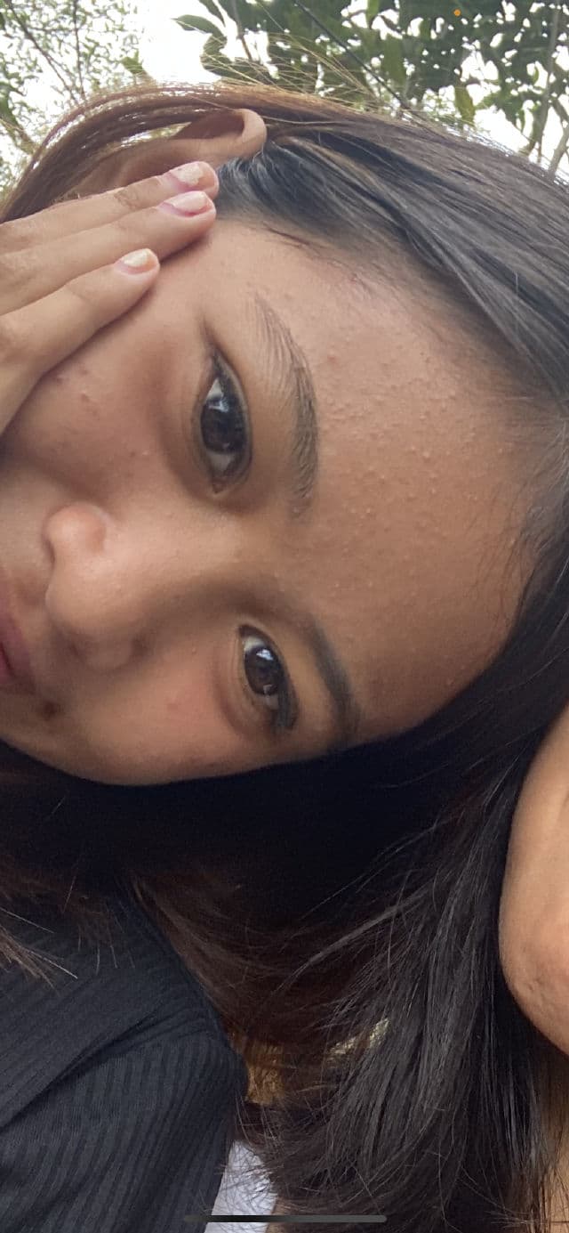 Luxe Organix Miracle Solutions Acne Derm+ Gel Cleanser review photo by cutiebunnyfinds