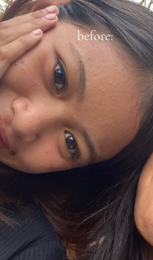 Luxe Organix Miracle Solutions Acne Derm+ Gel Cleanser review photo by cutiebunnyfinds