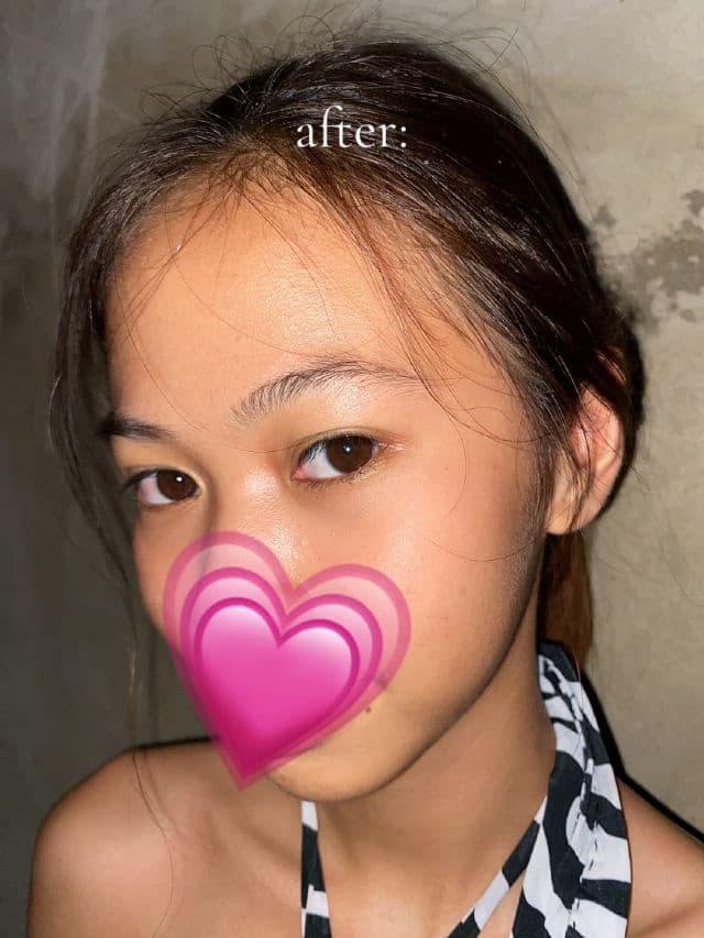 Luxe Organix Miracle Solutions Acne Derm+ Gel Cleanser review photo by cutiebunnyfinds