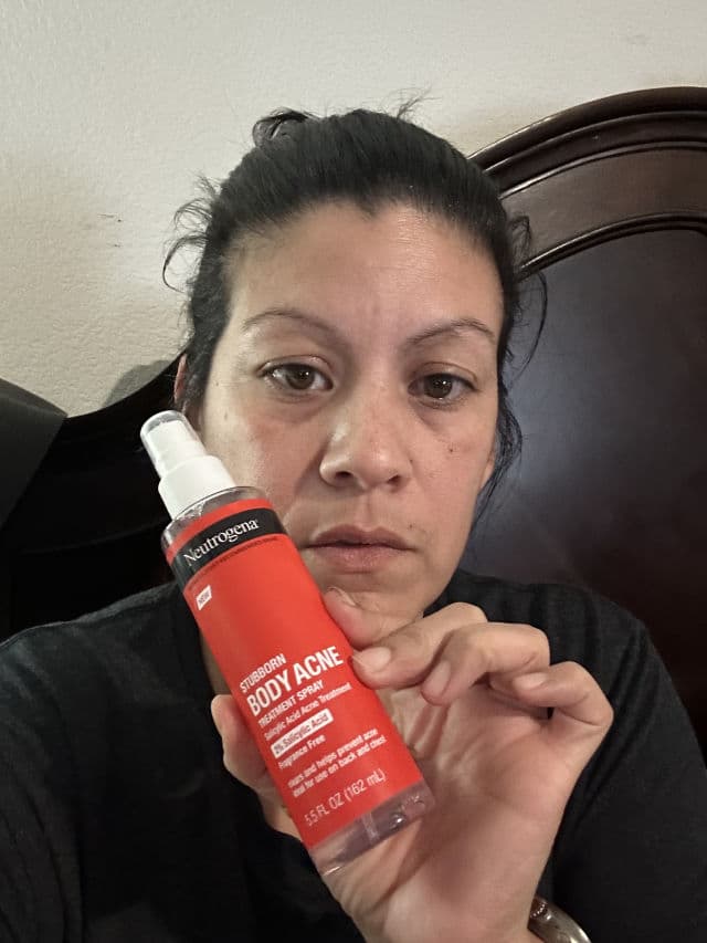 Neutrogena Stubborn Body Acne Treatment Spray with Salicylic Acid review photo by syfer