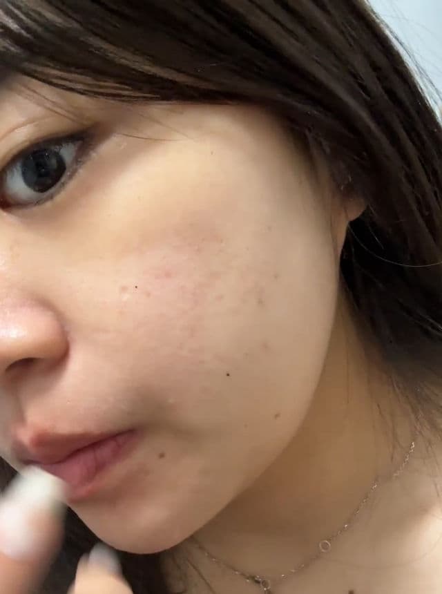 VT COSMETICS Garlic AC Reedle Shot Spot Cream review photo by yeeinaa