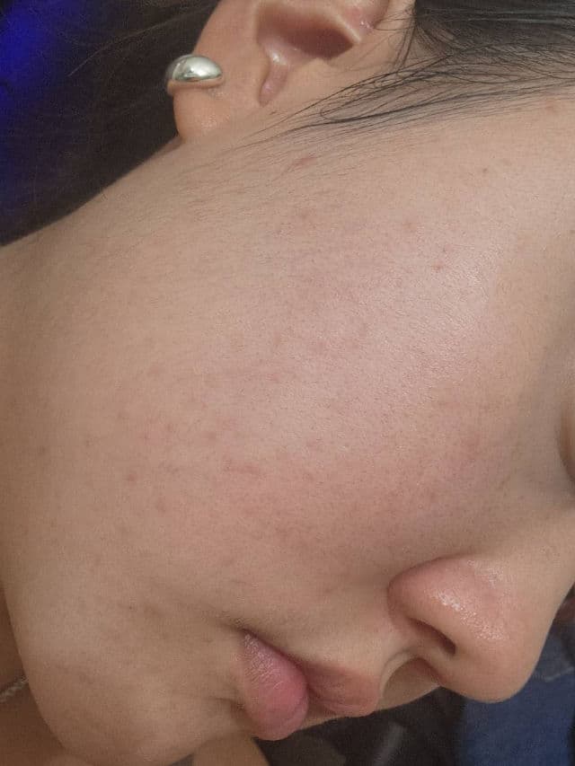 Retinol Cica Repair Ampoule product review