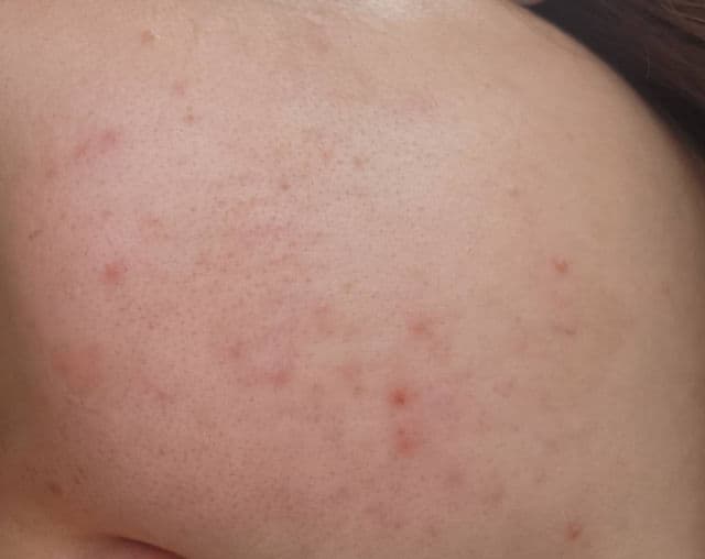 Retinol Cica Repair Ampoule product review