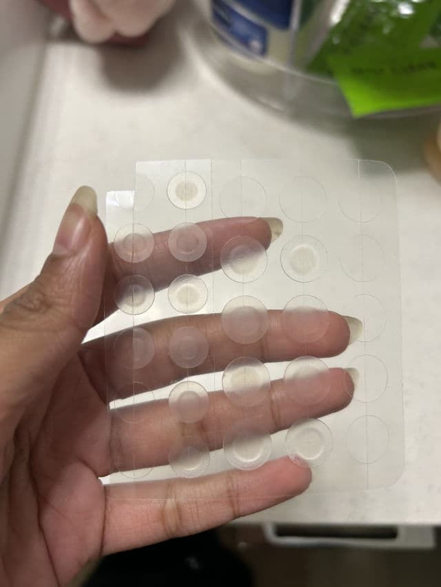 Nico Medical Catch Me Patch Spot Care & Cover review photo by luvvmiii