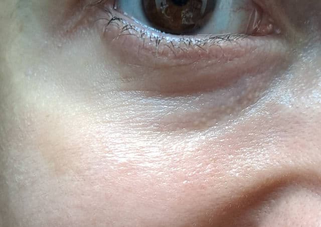 MediFlower Aronyx Vitamin Brightening Eye Cream review photo by ladybird