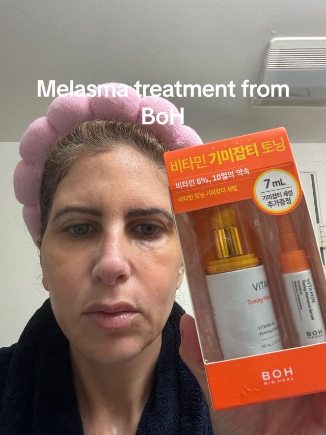 BIOHEAL BOH Vitamin Toning Melasma Serum  review photo by Nadine26