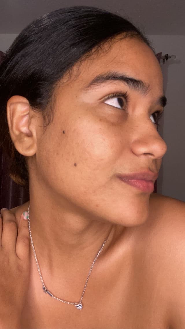 Garnier Micellar Cleansing Water with Vitamin C review photo by maygic