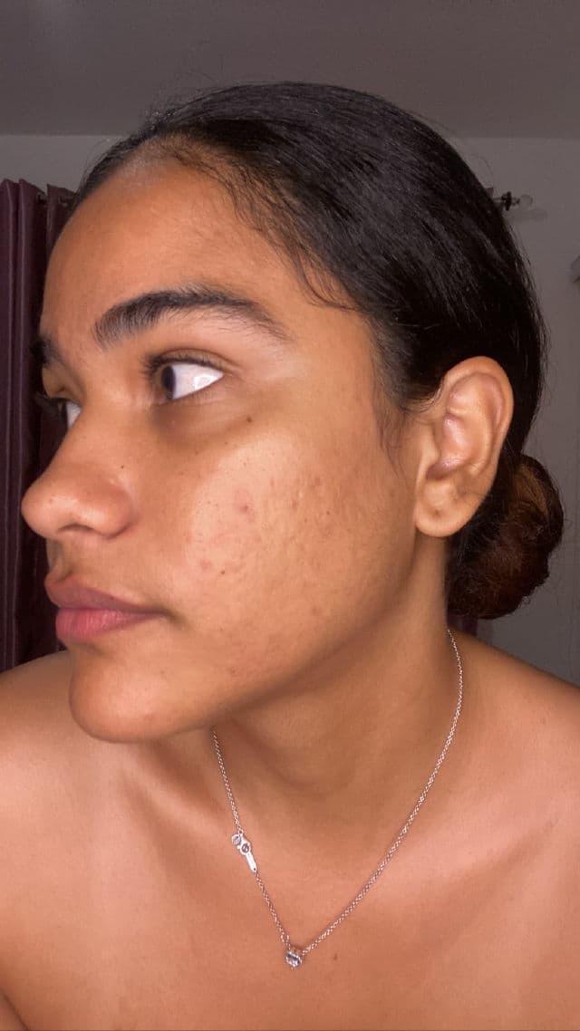 Garnier Micellar Cleansing Water with Vitamin C review photo by maygic