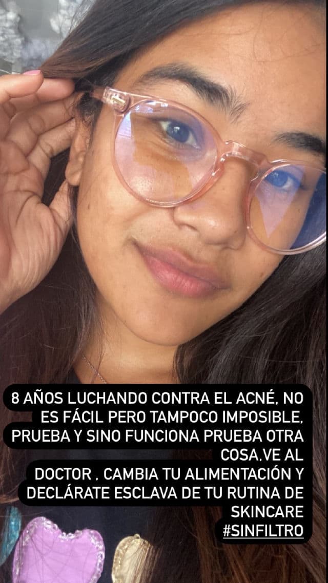 Garnier Micellar Cleansing Water with Vitamin C review photo by maygic