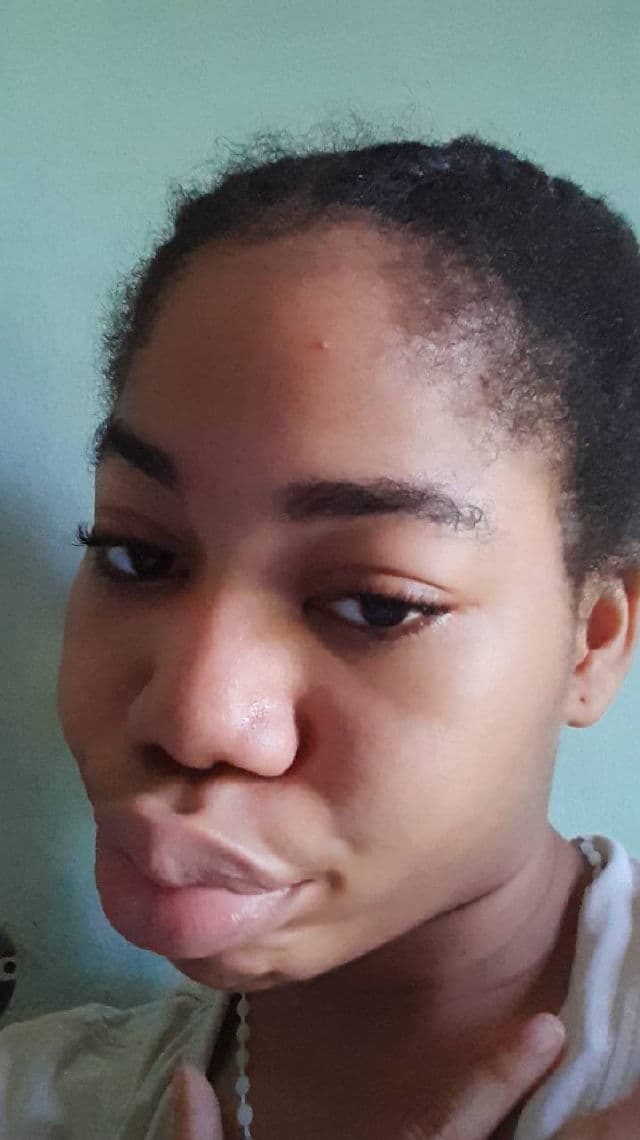 CURENTY Acne Clear Serum review photo by SkinWithNue