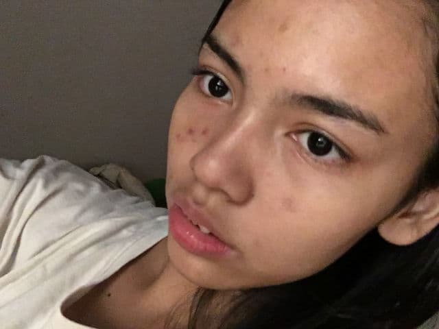 AXIS-Y Dark Spot Correcting Glow Serum review photo by KTORKTH11