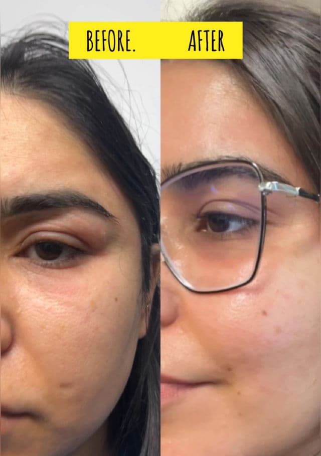 Meditherapy Exclusive Summer Care Trio 3-step Set review photo by neerja