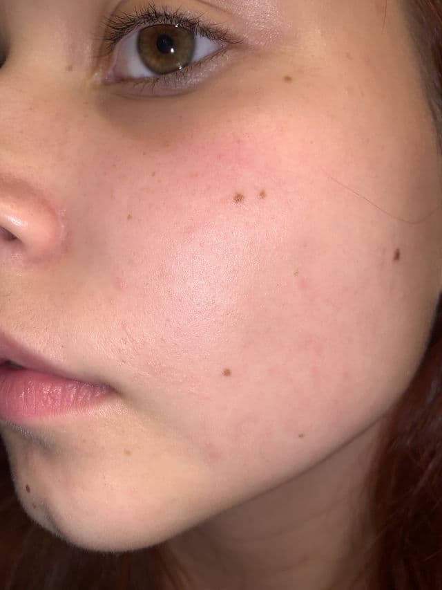 DEWYTREE AC Control Deep Green Calming Pad review photo by ssyringas