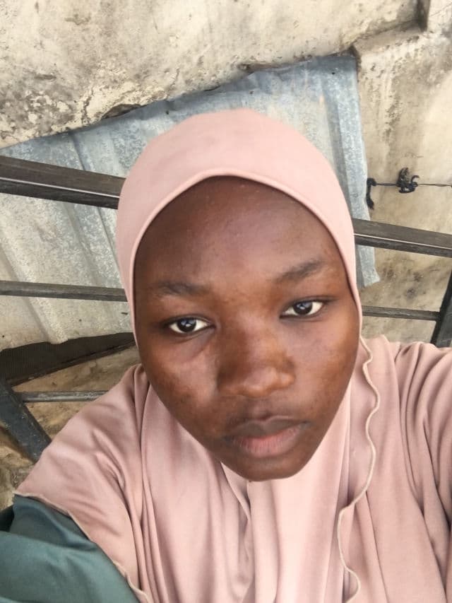 Touch Acne Treatment Gel - Benzoyl Peroxide 2.5% review photo by Moyo