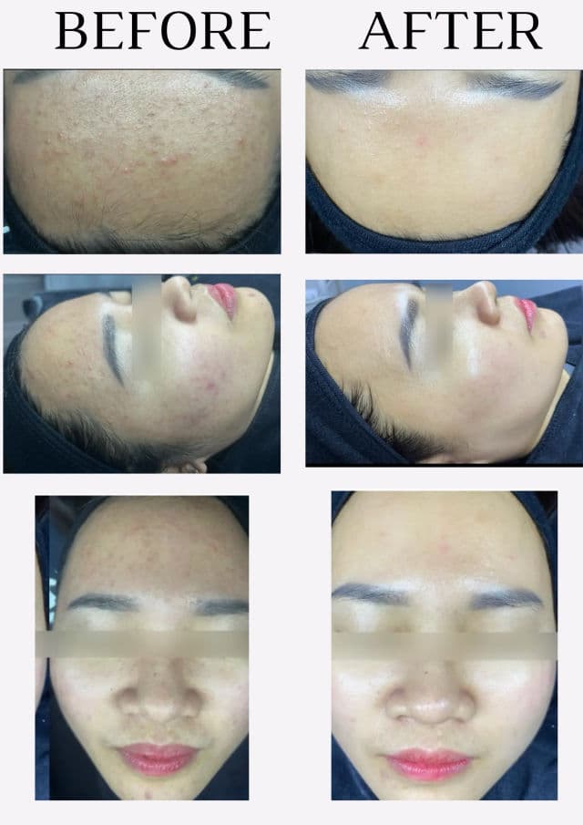 meideme Green Salvia Treatment Toner review photo by DucAnhLee