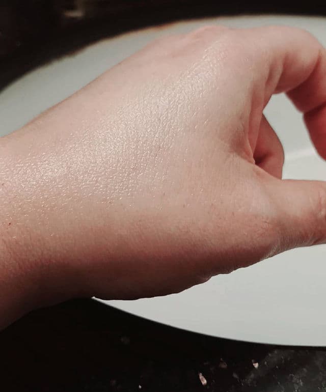 Centellian24 Madeca Cream Time Reverse review photo by TapIntoThis1