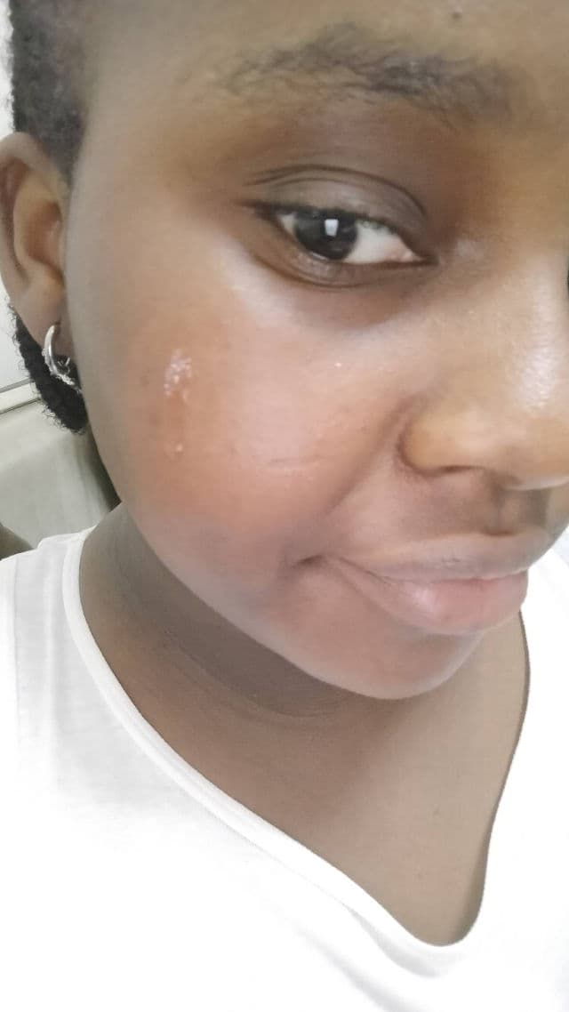 ANUA Niacinamide 10% + TXA 4% Dark Spot Correcting Serum review photo by Oreva