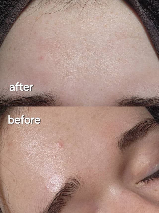 ANUA Heartleaf LHA Moisture Peeling Gel review photo by silviadicienzo