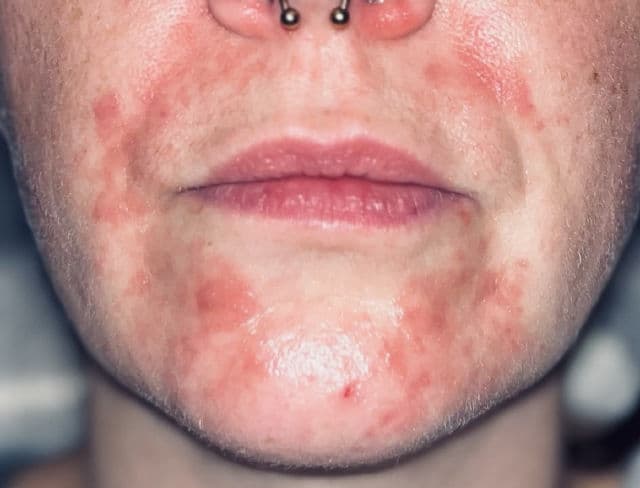 Aestura Atobarrier 365 Dermaon Sun Cream SPF30/PA++ review photo by Rachelle35