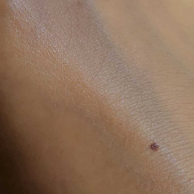 Mixa Hyalurogel Serum review photo by FrenchyPeach19