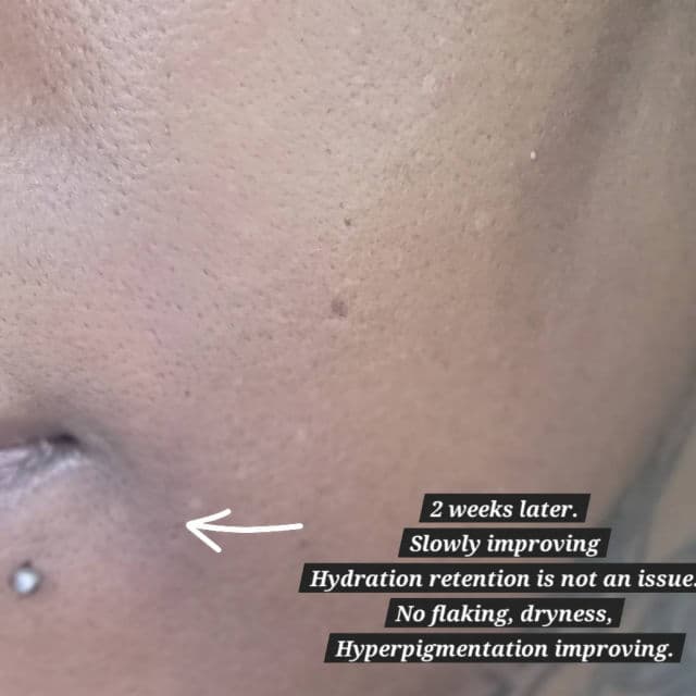 HaruHaru WONDER Black Rice Probiotics Barrier Essence review photo by TeejayTries