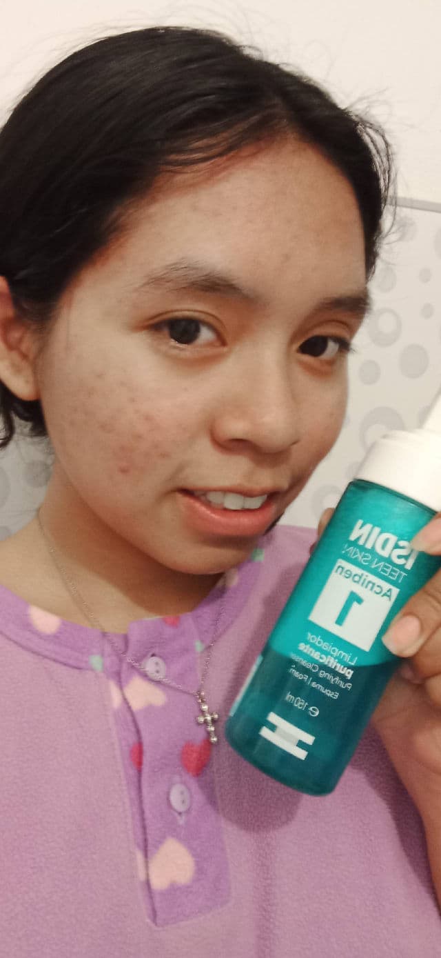 ISDIN Acniben Limpiador Matificante review photo by merrrr