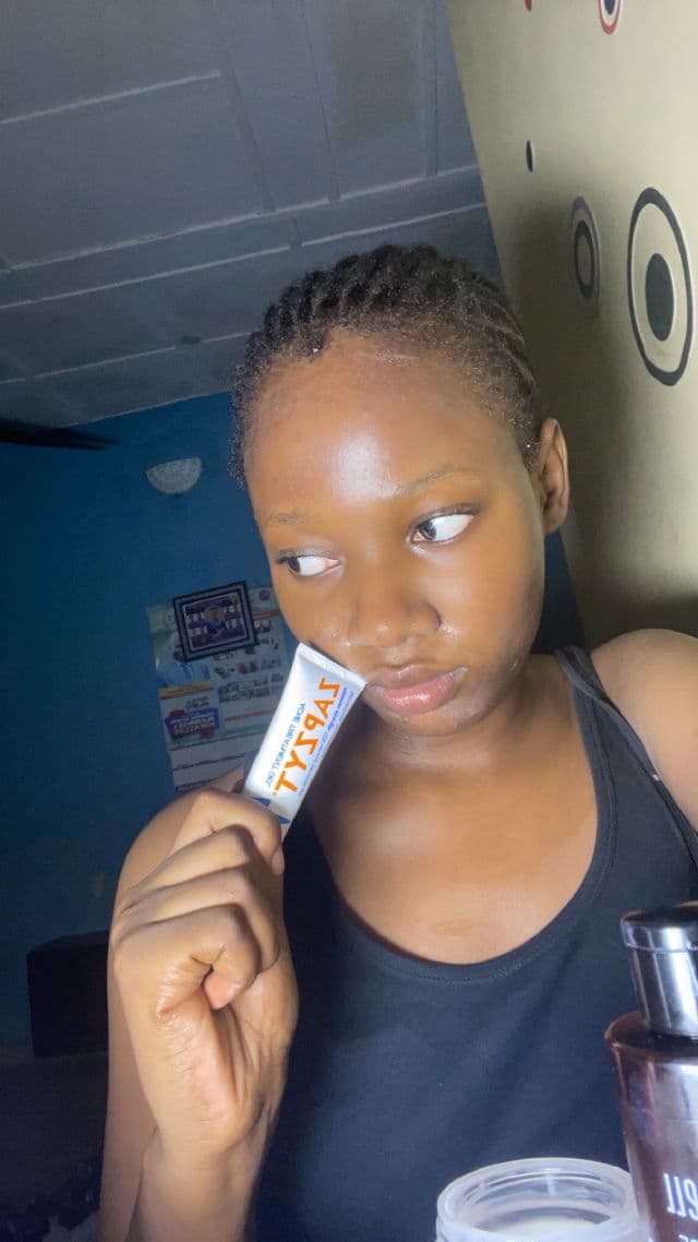 ZAPZYT Acne Treatment Gel review photo by chiszn