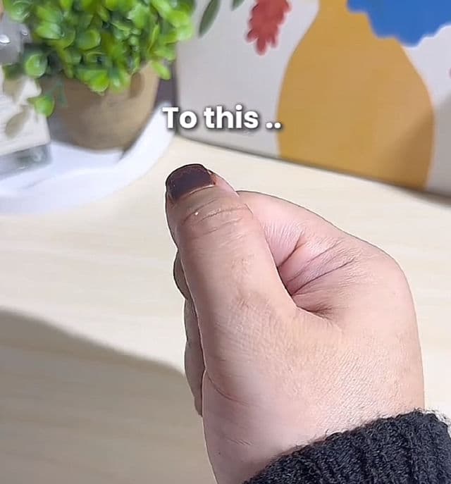 medi-peel Melanon X Cream review photo by KingLeny