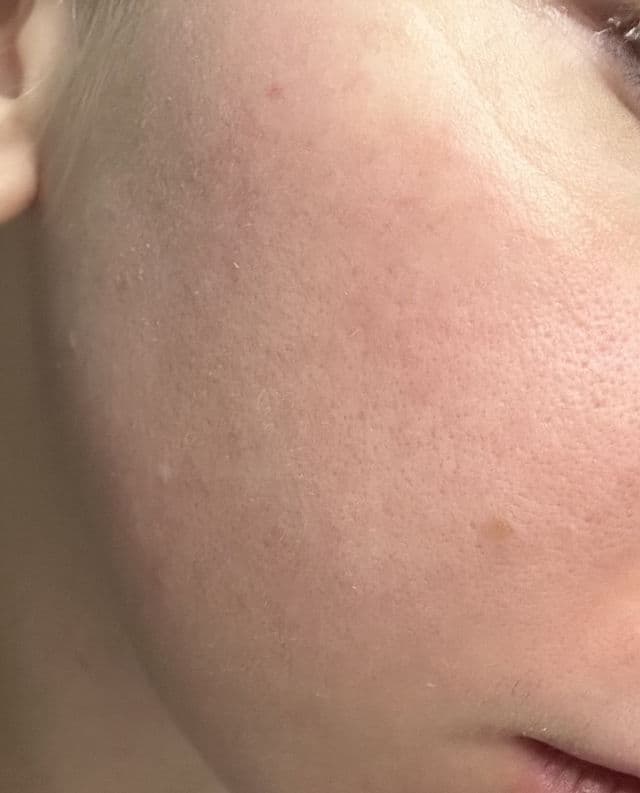 Sephora Collection Best Skin Ever Liquid Foundation review photo by roseAbstraite