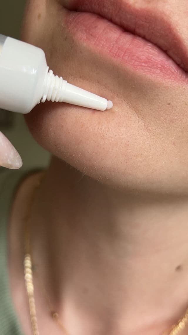 VT COSMETICS Garlic AC Reedle Shot Spot Cream review photo by MagdaKaistoura