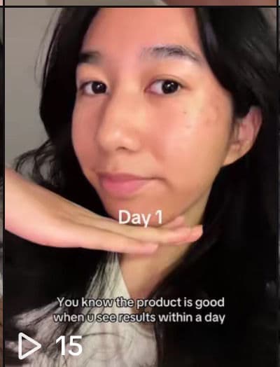 Centellian24 Madeca Cream Time Reverse review photo by flwrrosemika