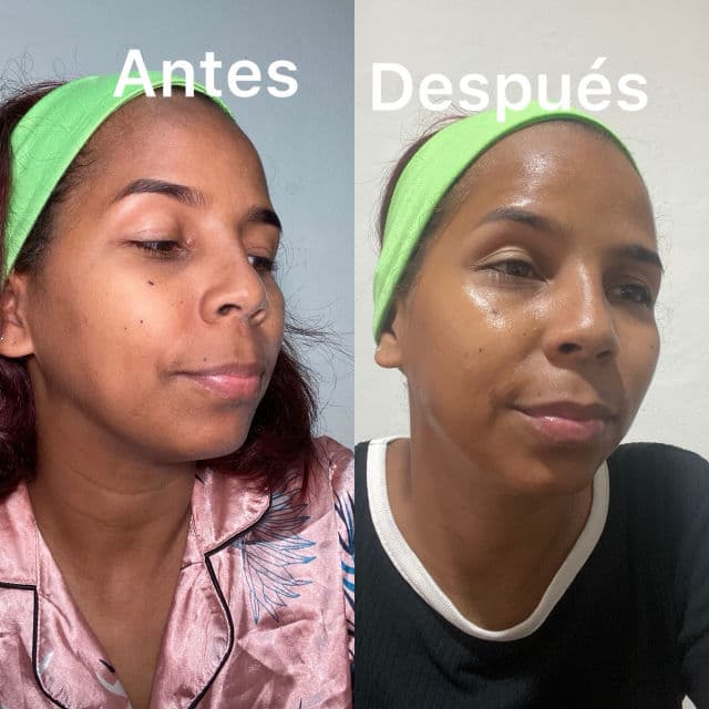 Centellian24 360° Shot PDRN Active Serum review photo by FancyVenturaB