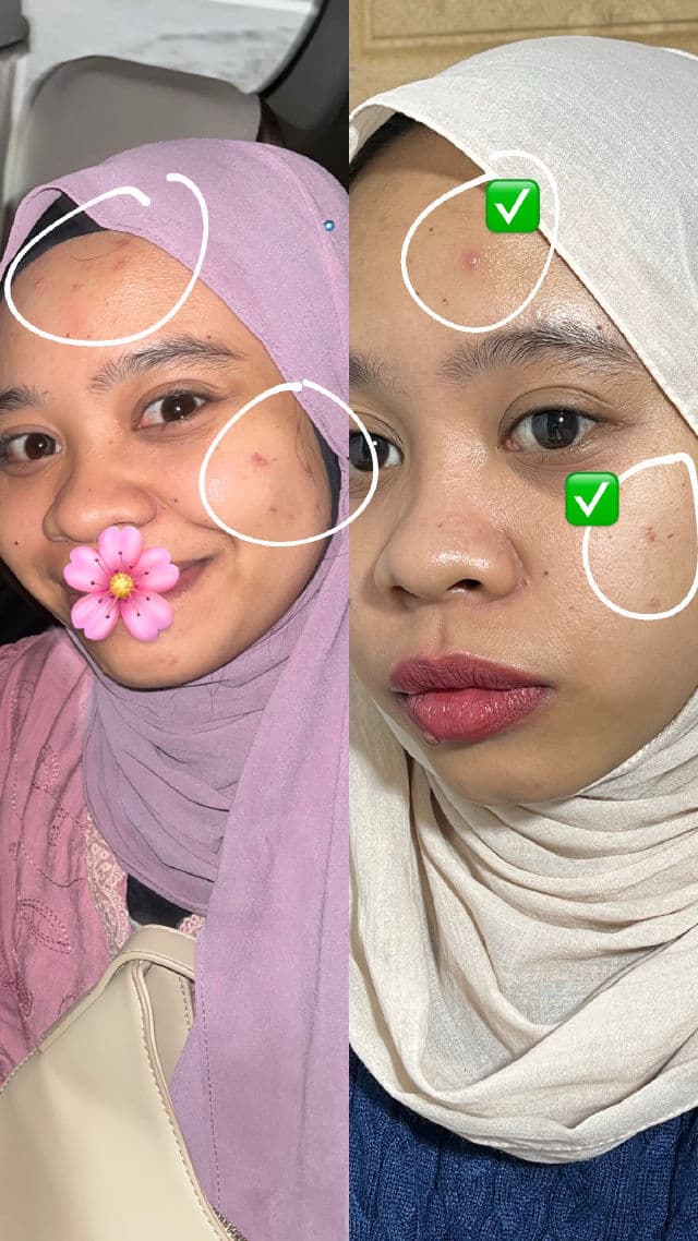 I'M FROM Black Rice Toner review photo by Icha