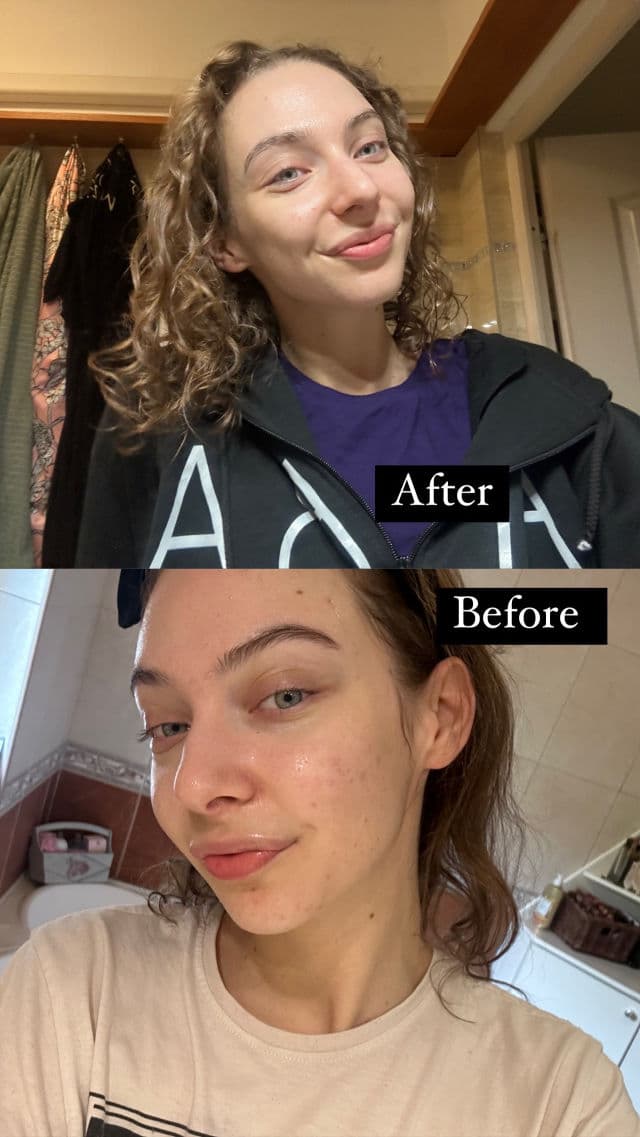 Balea Med Barriereschutz Creme Ultra Sensitive review photo by sabaao