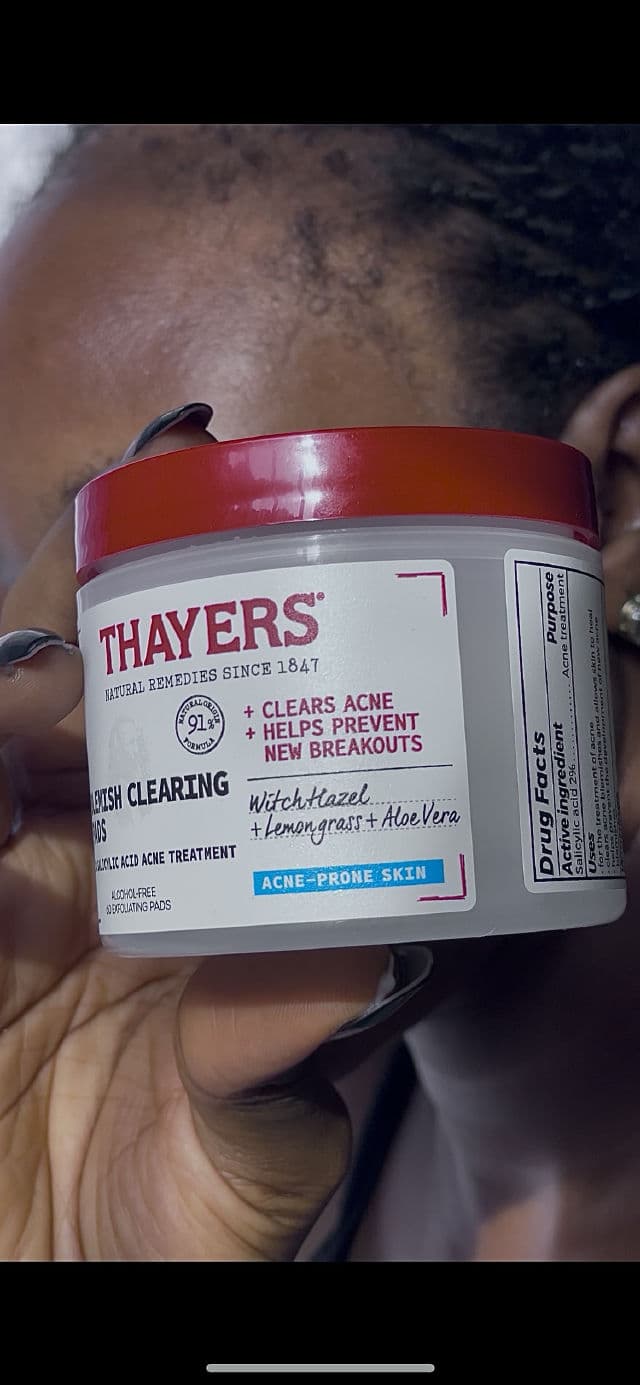 Thayers Blemish Clearing 2% Salicylic Acid Acne Treatment Pads review photo by adaeverafter