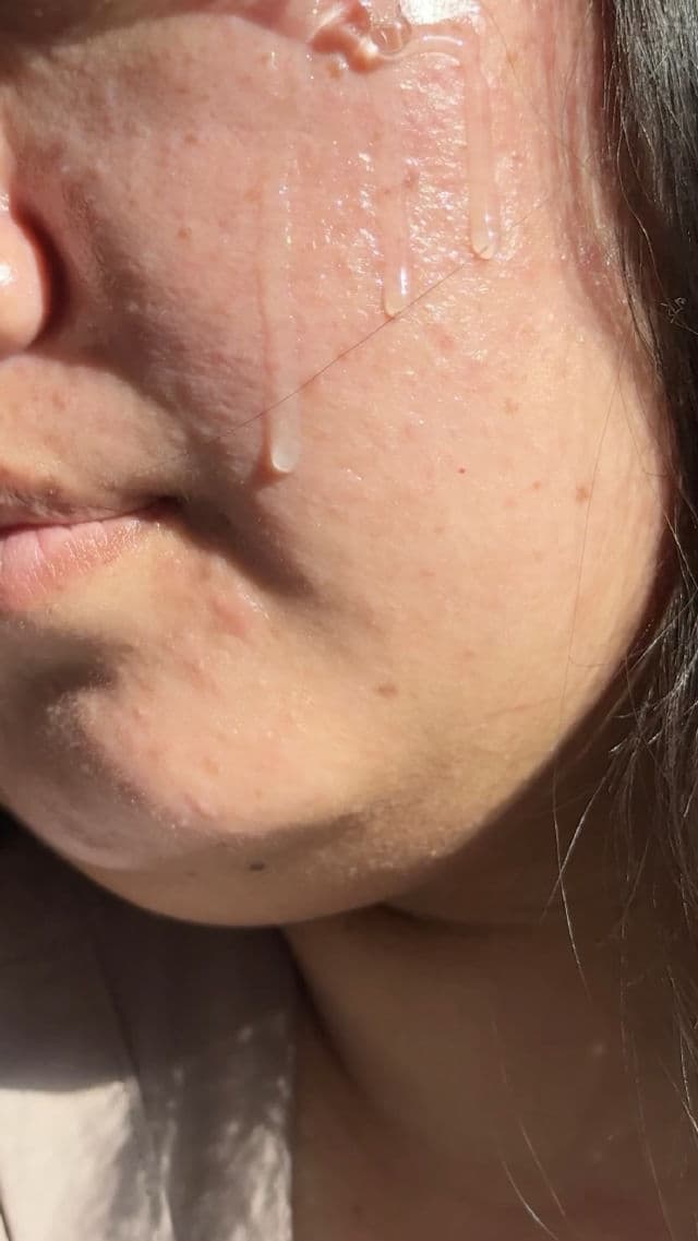 Wellage Real Hyaluronic Blue 100 Ampoule review photo by Roshani