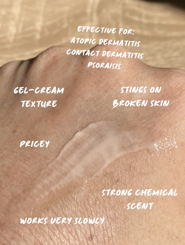 ALLIANCE Atopiclair Non Steroidal Cream review photo by pocelyn