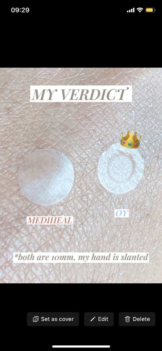 Olive Young Care Plus Scar Cover Spot Patch review photo by pocelyn