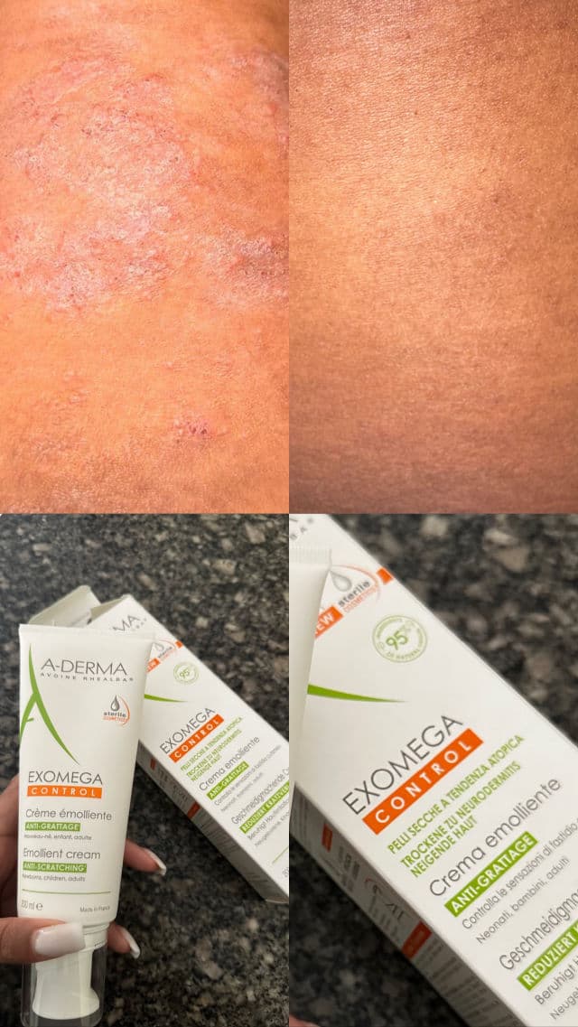 A-Derma Exomega Control Sterile Cosmetic Emollient Balm review photo by virgietarah