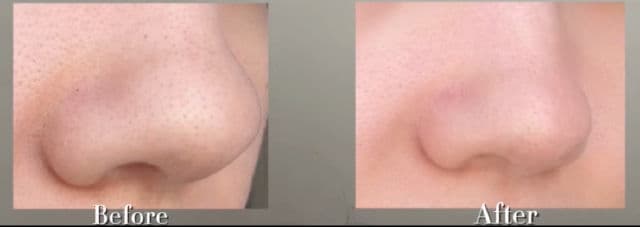 ILSO Super Melting Sebum Softener review photo by feruzacreates